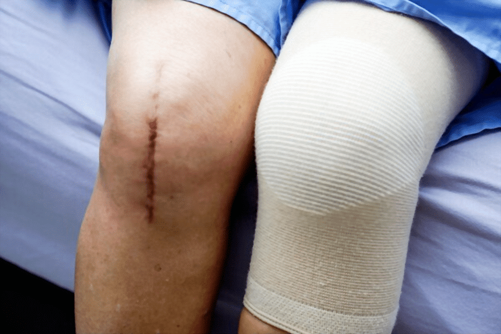 When do you want a Joint Replacement Surgical Operation?