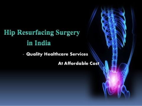 Hip Replacement Surgery Cost In India | Affordable & Advanced