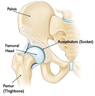 Hip Joint Replacement Surgery in India