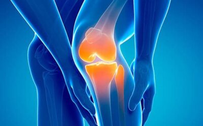 Hip Joint Replacement Recovery Time