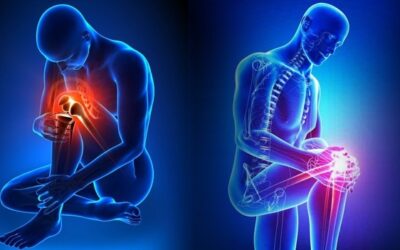 Things to Remember before Going for the Joint Replacement Surgery
