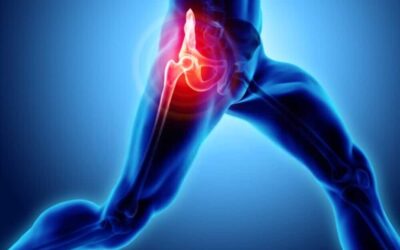 What Is the price of Hip Replacement Surgery in India?