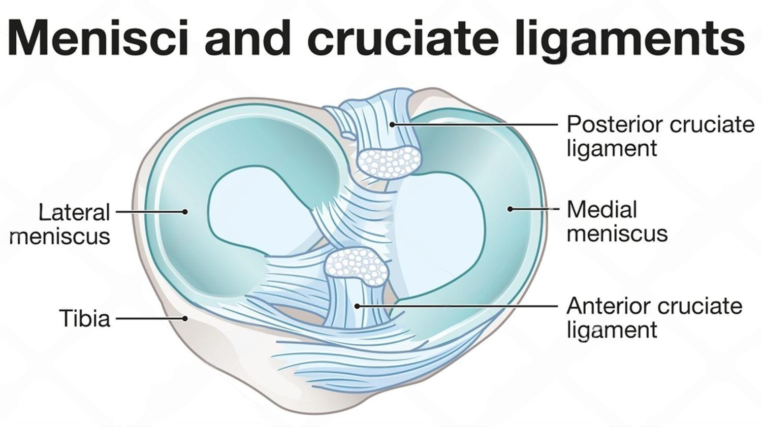 ACL graft options: hamstring, quadriceps tendon, patellar tendon - Delhi