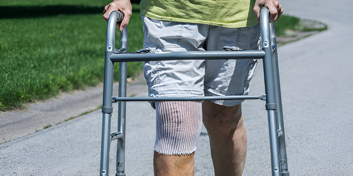 Robotic Knee Replacement in Delhi - patient walking after precise alignment