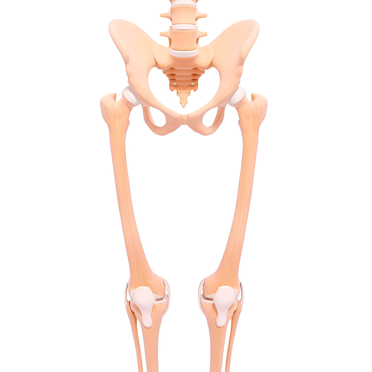Work-up for revision joint replacement - imaging and lab evaluation