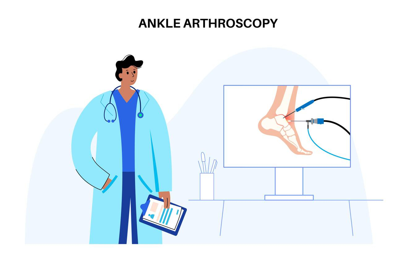 Keyhole portals diagram for Arthroscopic Surgery in Delhi