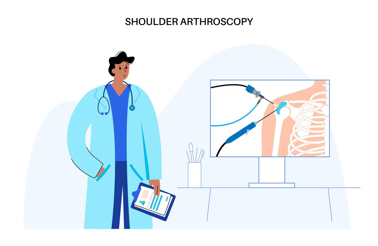 Physiotherapy after Arthroscopic Surgery in Delhi