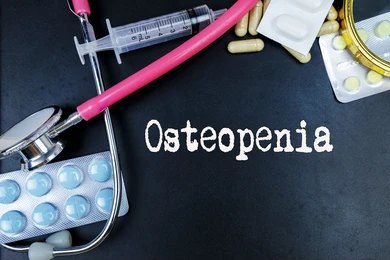 Osteopenia: Symptoms, T-Scores, Causes, Treatment & Prevention Guide