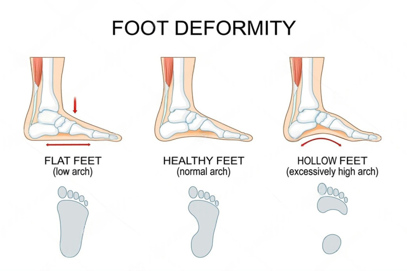 Hindfoot alignment view and deformity assessment in Delhi