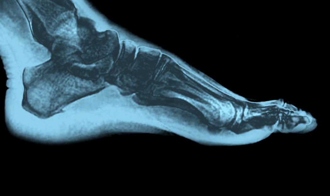 Weight-bearing foot and ankle X-rays for alignment planning in Delhi